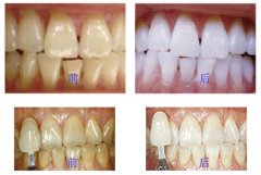 S׃׵ĺ(jin)ηSô׃
